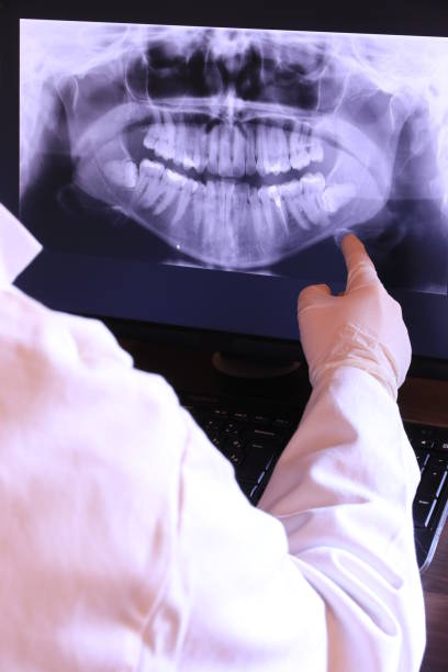 Best Broken or Chipped Tooth Repair in South Plainfield, NJ