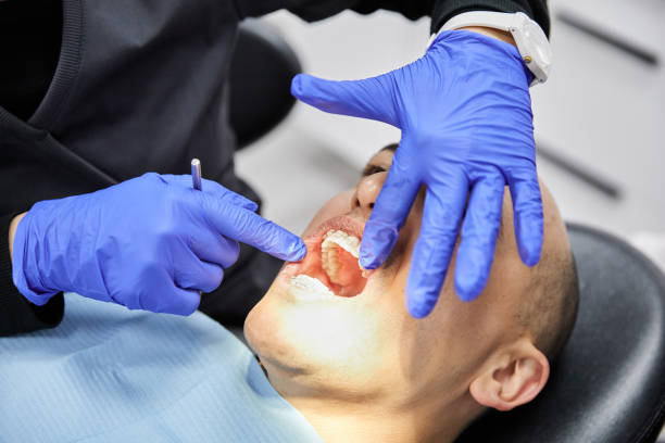 Best Knocked-Out Tooth (Avulsed Tooth) Treatment in South Plainfield, NJ